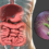 L’Helicobacter Pylori : Comprendre cette bactérie et son impact sur la santé digestive